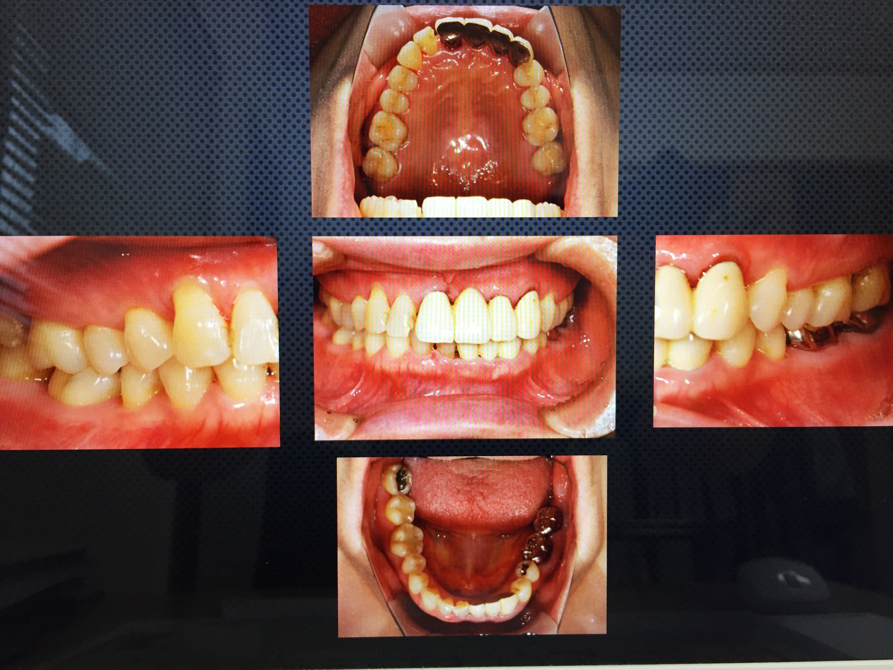 八幡西区で小児歯科をお探しなら無痛治療の、いまむら歯科クリニック